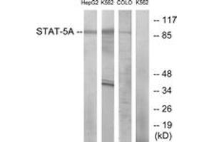Western blot analysis of extracts from HepG2/K562/COLO cells, using STAT5A (Ab-694) Antibody. (STAT5A 抗体  (AA 666-715))