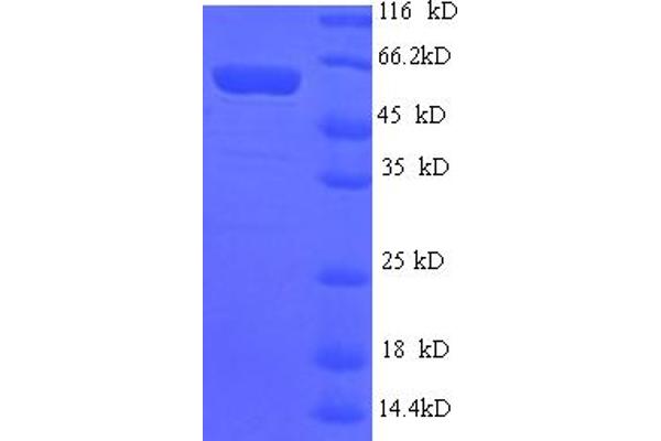 ART1 Protein (AA 23-295) (GST tag)