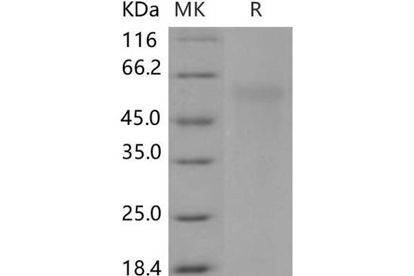 NGFR Protein (His tag)