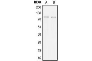 Western blot analysis of SYK expression in BJAB (A), Ramos (B) whole cell lysates. (SYK 抗体  (Center))
