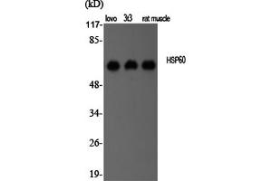 Western Blotting (WB) image for anti-Heat Shock 60kDa Protein 1 (Chaperonin) (HSPD1) antibody (ABIN5956900) (HSPD1 抗体)