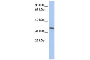 C10ORF96 antibody used at 1 ug/ml to detect target protein. (C10ORF96 抗体  (Middle Region))