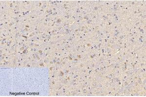 Immunohistochemical analysis of paraffin-embedded mouse brain tissue. (CD4 抗体)