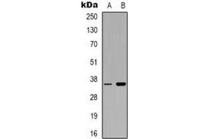 Western blot analysis of CD321 expression in Hela (A), PC12 (B) whole cell lysates. (F11R 抗体)