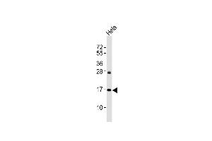 Anti p16-INK4A Antibody at 1:2000 dilution + Hela whole cell lysates Lysates/proteins at 20 μg per lane. (CDKN2A 抗体  (Ser152))