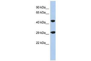 C22ORF25 antibody used at 1 ug/ml to detect target protein. (C22orf25 抗体  (N-Term))