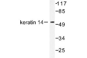 Image no. 1 for anti-Keratin 14 (KRT14) antibody (ABIN265493) (KRT14 抗体)