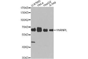 Western blot analysis of extracts of various cell lines, using HNRNPL antibody (ABIN5974591) at 1/1000 dilution. (HNRNPL 抗体)