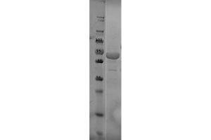 SDS-PAGE of OspC Control Protein. (OspC 蛋白)