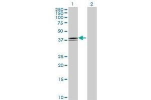 Lane 1: LEFTY2 transfected lysate ( 40. (LEFTY2 293T Cell Transient Overexpression Lysate(Denatured))