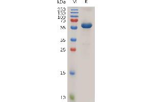 Human PRLR Protein, hFc Tag on SDS-PAGE under reducing condition. (Prolactin Receptor Protein (PRLR) (AA 25-234) (Fc Tag))