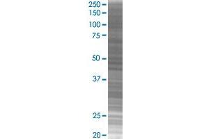 Western Blotting (WB) image for GYPA 293T Cell Transient Overexpression Lysate(Denatured) (ABIN1332065)