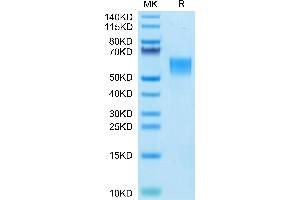 Human ENPP-3(558-875) on Tris-Bis PAGE under reduced condition. (ENPP3 Protein (AA 558-875) (His tag))