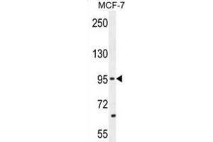 Western Blotting (WB) image for anti-Protocadherin 20 (PCDH20) antibody (ABIN2996299) (PCDH20 抗体)