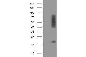 Western Blotting (WB) image for anti-CCR4-NOT Transcription Complex Subunit 4 (CNOT4) (AA 190-455) antibody (ABIN1491100) (CNOT4 抗体  (AA 190-455))