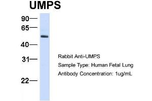 Host:  Rabbit  Target Name:  UMPS  Sample Type:  Human Fetal Lung  Antibody Dilution:  1. (UMPS 抗体  (C-Term))