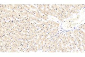 Detection of LAMC3 in Human Liver Tissue using Polyclonal Antibody to Laminin Gamma 3 (LAMC3) (LAMC3 抗体  (AA 901-1100))