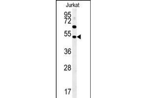 SSN1 Antibody (Center) (ABIN652058 and ABIN2840526) western blot analysis in Jurkat cell line lysates (35 μg/lane). (SAMSN1 抗体  (AA 255-283))