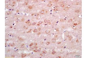 Formalin-fixed and paraffin embedded rat brain labeled with Anti-WNT7B Polyclonal Antibody, Unconjugated (ABIN716291) at 1:200 followed by conjugation to the secondary antibody and DAB staining (WNT7B 抗体  (N-Term))