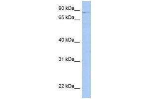 LRRC33 antibody used at 1 ug/ml to detect target protein. (LRRC33 抗体  (Middle Region))