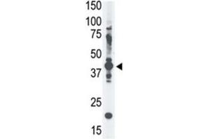 Western Blotting (WB) image for anti-Melanoma Antigen Family A, 4 (MAGEA4) antibody (ABIN3002532) (MAGEA4 抗体)