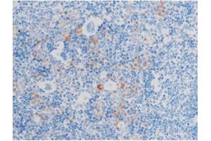 ABIN6267553 at 1/200 staining Mouse spleen tissue sections by IHC-P. (LIMK-1/2 (pThr505), (pThr508) 抗体)