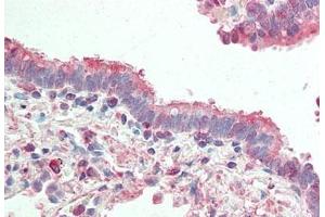 Human Lung, Respiratory Epithelium: Formalin-Fixed, Paraffin-Embedded (FFPE) (ATG4B 抗体)