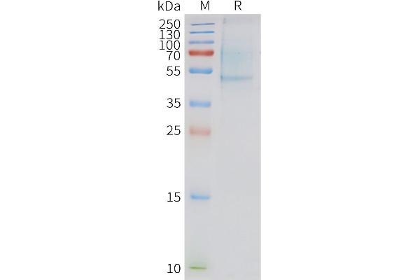 Apelin Receptor Protein (APLNR)