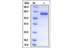 Mouse Dkk-3, His Tag on SDS-PAGE under reducing (R) condition. (DKK3 Protein (AA 23-349) (His tag))