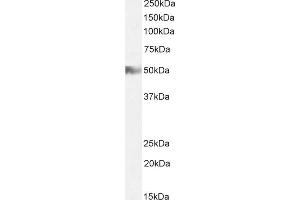 Western Blotting (WB) image for anti-Histamine Receptor H2 (HRH2) (C-Term) antibody (ABIN185463)