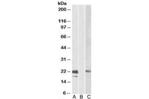 Western blot testing of HEK293 lysate overexpressing human CST8-MYC probed with Cystatin 8 antibody [0. (CST8 抗体)