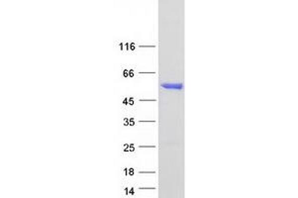 ALDH6A1 Protein (Myc-DYKDDDDK Tag)