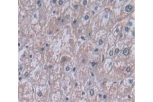 IHC-P analysis of Human Tissue, with DAB staining. (PIGR 抗体  (AA 19-120))