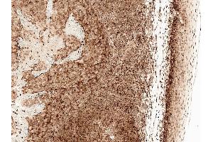 Immunohistochemistry analysis using Rabbit Anti-CCR2 Polyclonal Antibody (ABIN5066710). (CCR2 抗体  (PerCP))