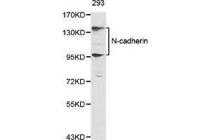Western Blotting (WB) image for anti-Cadherin 2 (CDH2) (AA 450-550) antibody (ABIN6213846) (N-Cadherin 抗体  (AA 450-550))
