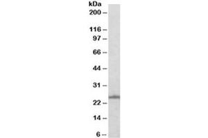 Western blot testing of A431 with RAN antibody at 0. (RAN 抗体)