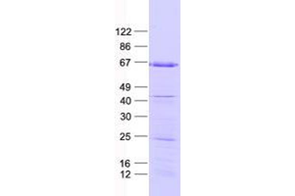 ZNF354A Protein (His tag)