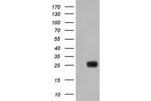 Western Blotting (WB) image for anti-MOB Kinase Activator 3B (MOB3B) antibody (ABIN1499534) (MOBKL2B 抗体)