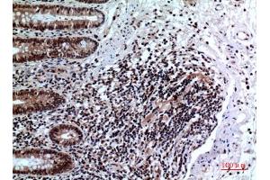 Immunohistochemical analysis of paraffin-embedded human-colon, antibody was diluted at 1:100. (FOXP3 抗体  (C-Term))