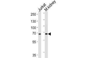 Western Blotting (WB) image for anti-Transcription Factor 12 (TCF12) antibody (ABIN2998276) (TCF12 抗体)