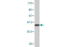 Western Blot detection against Immunogen (37. (LMX1B 抗体  (AA 1-110))