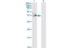 Western Blotting (WB) image for anti-Crystallin, mu (CRYM) (AA 215-314) antibody (ABIN560481)