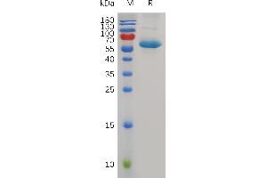 Human CD72 Protein, hFc Tag on SDS-PAGE under reducing condition. (CD72 Protein (Fc Tag))