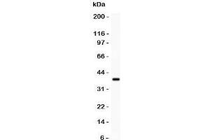 Western blot testing of FHIT antibody and recombinant human protein (0. (FHIT 抗体  (AA 1-147))