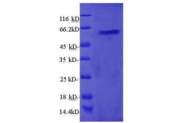 RPL5 Protein (AA 2-297, full length) (GST tag)