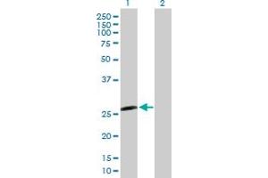 Western Blot analysis of IL6 expression in transfected 293T cell line by IL6 MaxPab polyclonal antibody. (IL-6 抗体  (AA 1-212))