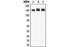 Western blot analysis of eNOS (pS1177) expression in A549 (A), HuvEc (B), rat brain (C) whole cell lysates. (ENOS 抗体  (C-Term, pSer1177))