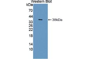 Western blot analysis of the recombinant protein. (HSD17B12 抗体  (AA 1-312))