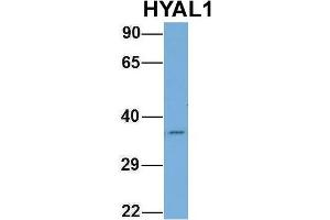 Western Blotting (WB) image for anti-Hyaluronidase-1 (HYAL1) (N-Term) antibody (ABIN2784342)