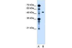 ZFYVE27 antibody used at 1. (ZFYVE27 抗体  (Middle Region))